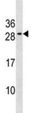 Bcl-2 antibody western blot analysis in MDA-MB453 lysate