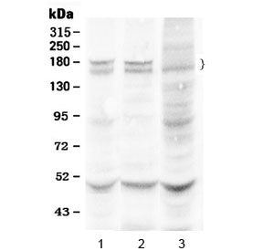 Thrombospondin Antibody / THBS1
