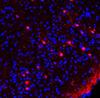 Immunofluorescent staining of FFPE mouse brain tissue with Calretinin antibody (red) and DAPI nuclea