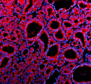 Immunofluorescent staining of Teneurin 1/TENM1 using anti-TENM1 antibody (red). Teneurin 1/TENM1 was