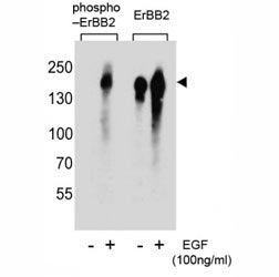 Western blot analysis of extracts from A431 cells, untreated or treated with EGF, using phospho-ERBB