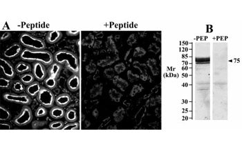 Image A: IHC staining of a rat kidney cryosection with Slc5a1 antibody at 25ug/ml (detection by CY3 