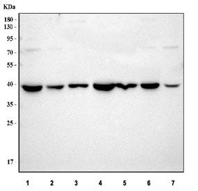 Western blot testing of 1) rat heart, 2) rat kidney, 3) rat brain, 4) mouse heart, 5) mouse kidney, 