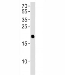 Western blot analysis of lysate from 293T cell line using HRAS antibody diluted at 1:1000. Predicted