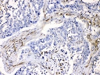 VASP Antibody