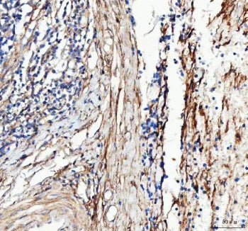 IHC staining of FFPE human tonsil tissue with COL3A1 antibody. HIER: boil tissue sections in pH8 EDT