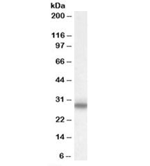 Western blot testing of rat spinal cord lysate with Myelin Protein Zero antibody at 0.1ug/ml. Predic