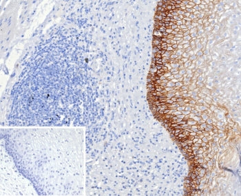 IHC testing of FFPE human esophagus tissue with CD44v6 antibody (clone CD44V6/2496). Required HIER: 