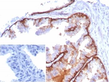 IHC staining of FFPE human tonsil tissue with Cytokeratin 5 antibody (clone KRT5/8814R). Inset: PBS 