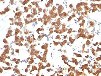 Cytokeratin 18 Antibody