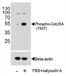 Western blot analysis of extracts from HeLa cells, untreated or treated with Calyculin A, using phos