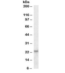 Western blot testing of HeLa lysate with IL-18 antibody at 0.1ug/ml. Predicted molecular weight ~23k