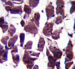 LRIG2 antibody immunohistochemistry analysis in formalin fixed and paraffin embedded human skeletal 