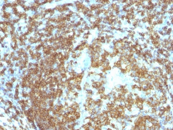 IHC staining of FFPE human tonsil with CD45RA antibody (clone 158-4D3). HIER: boil tissue sections i