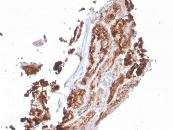 IHC staining of FFPE human kidney with RBP4 antibody. HIER: boil tissue sections in pH 9 10mM Tris w