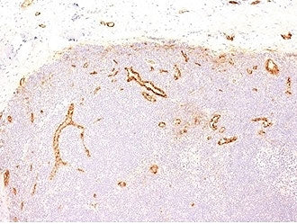 von Willebrand Factor Antibody / vWF