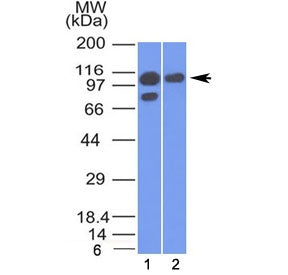 Alpha Catenin Antibody