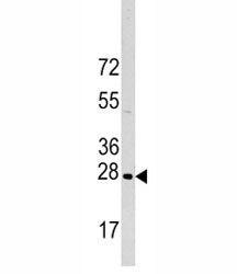 HSP27 Antibody (HSPB1)