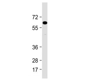 Western blot testing of mouse liver lysate with IL1RAP antibody at 1:2000. Predicted molecular weigh