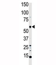 MST1 Antibody (Mammalian STE20-like protein kinase 1)