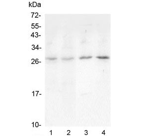 Oncostatin M Antibody / OSM