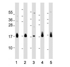 Western blot testing of CD59 antibody at 1:2000: Lane 1) human HUVEC, 2) BxPC-3, 3) PC-3, 4) breast 