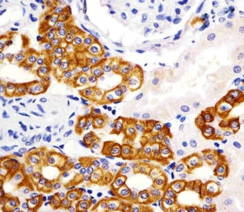 IHC testing of FFPE human kidney tissue with Keratin 19 antibody. HIER: steam section in pH6 citrate