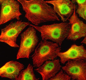 Immunofluorescent staining of NCOR1 using anti-NCOR1 antibody (green) and anti-Beta Tubulin antibody