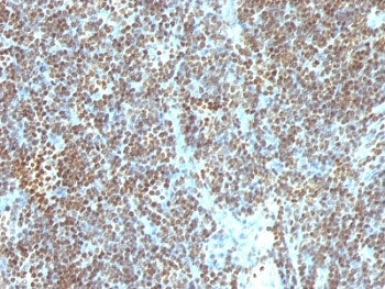 IHC: Formalin-fixed, paraffin-embedded human tonsil stained with Double Stranded DNA antibody (SPM60
