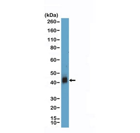 Western blot testing of human Jurkat cell lysate with recombinant CD38 antibody at 1:1000 dilution. 