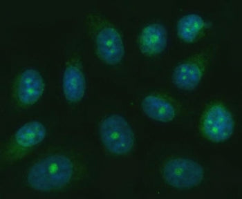 TRANK1 Antibody / TPR and ankyrin repeat-containing protein 1