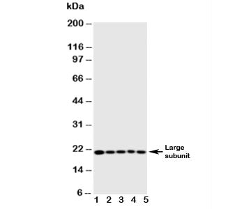 Western blot testing of human 1) MCF-7, 2) HeLa, 3) Jurkat, 4) CCRF-CEM, 5) SW620 cell lysate with C