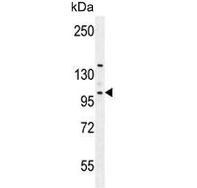 Western blot testing of human K562 cell lysate with Villin-like protein antibody. Predicted molecula