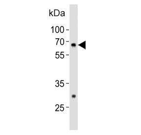 Western blot testing of mouse spleen tissue lysate with Gnl3 antibody. Predicted molecular weight ~6