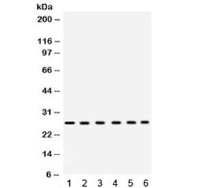Western blot testing of 1) rat heart, 2) rat liver, 3) mouse liver, 4) human placenta, 5) COLO320 an