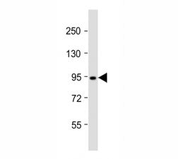 Western blot testing of Dnmt3b antibody at 1:2000 dilution + T47D lysate; Predicted molecular weight
