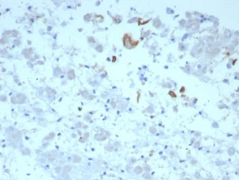 IL-6 Antibody