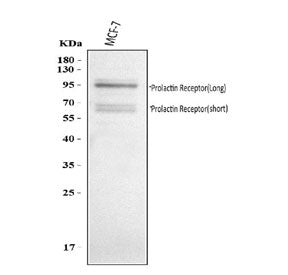 Prolactin Receptor Antibody / PRLR