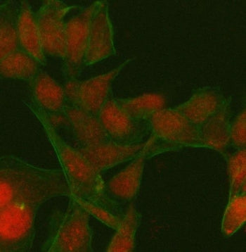 Immunofluorescent staining of FFPE human HeLa cells with PATZ1 antibody (red) and Beta Tubulin mAb (