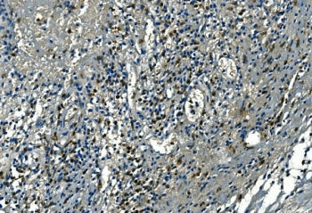 IHC staining of FFPE human appendicitis tissue with Azurocidin antibody. HIER: boil tissue sections 