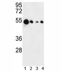 AIM2 Antibody
