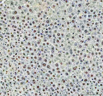 IHC staining of FFPE mouse liver tissue with DCK antibody. HIER: boil tissue sections in pH8 EDTA fo