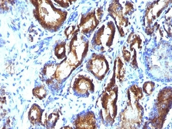 PSA Antibody Cocktail / Prostate Specific Antigen