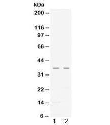 CXCL16 Antibody