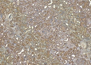IHC staining of FFPE human kidney tissue with ROBO1 antibody at 6ug/ml. Required HIER: steamed antig
