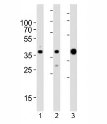 Western blot analysis of lysate from 1) MCF-7, 2) HeLa cell line and 3) human skeletal muscle tissue