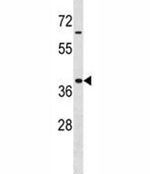 Hoxa9 antibody western blot analysis in MDA-MB453 lysate. Expected/observed molecular weight: ~30kDa