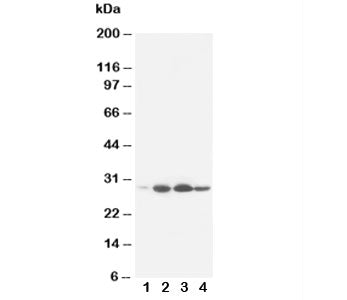 Western blot testing of Bcl-2 antibody and rat tissue: 1. heart; 2. spleen; 3. small intestine; 4: l