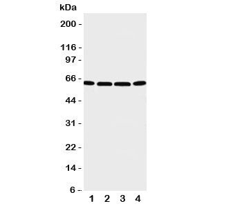 Western blot testing of P2X6 antibody and Lane 1: U87; 2: 22RV1; 3: Jurkat; 4: HT1080 cell lysate. E