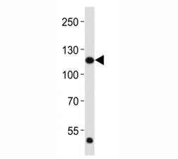 FGFR1 Antibody